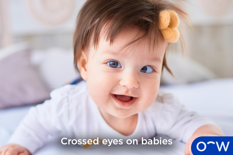 A image showing the uncontrolled eye movements of nystagmus.