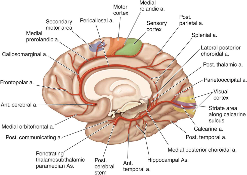 MRI image of brain affected by hemorrhagic stroke