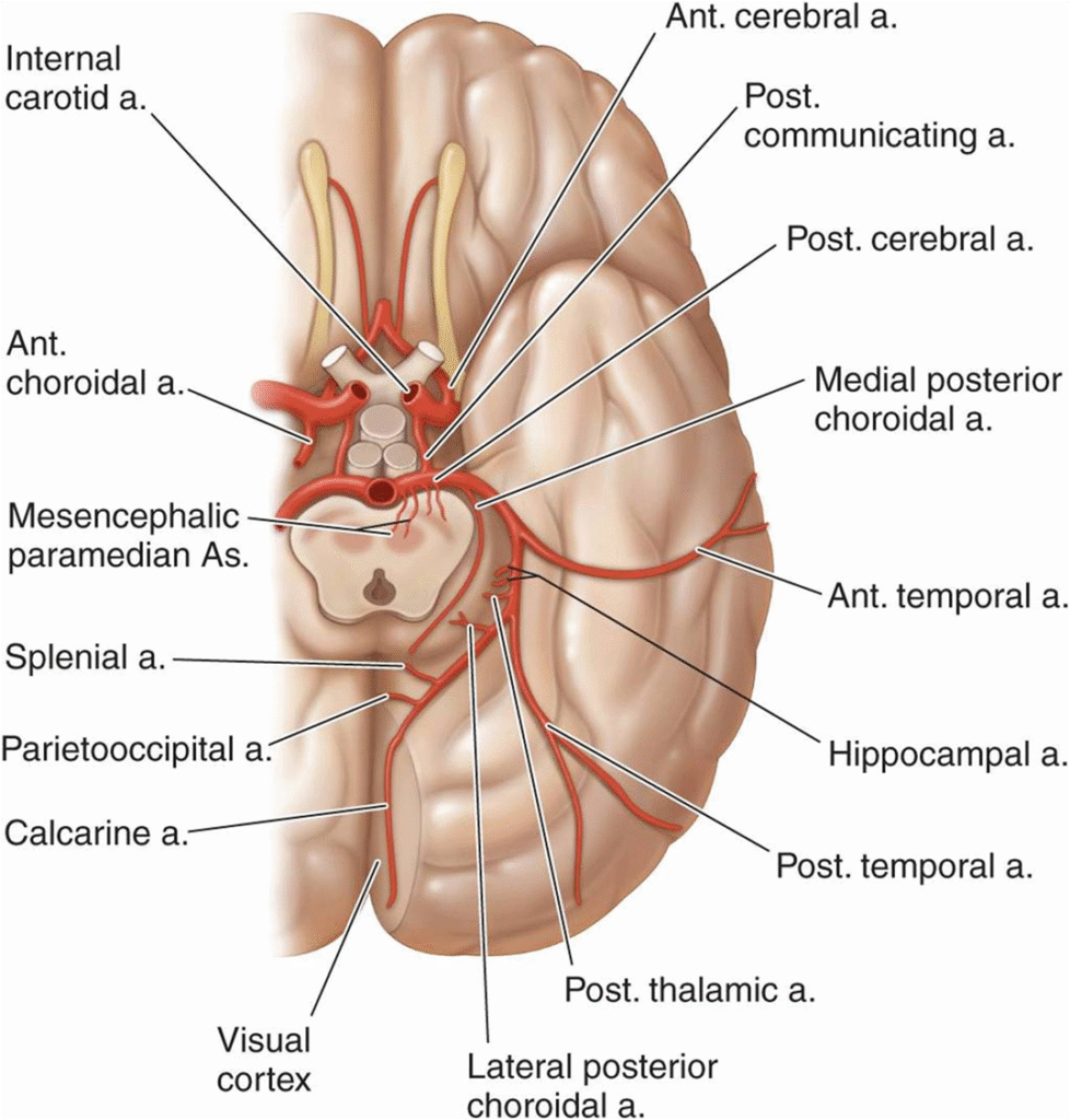 MRI image of brain affected by hemorrhagic stroke