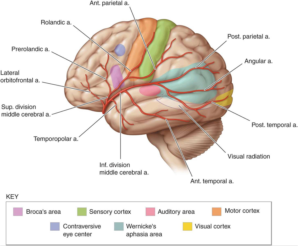Brain diagram showing ischemic stroke and blood clot