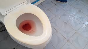 Blood in toilet as a sign of gastrointestinal problem